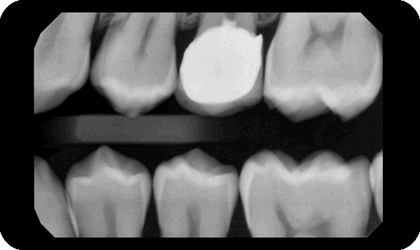 Use AI to highlight findingsresized