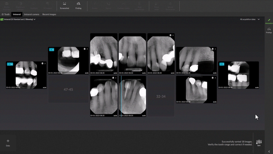 2D Dental Findings
