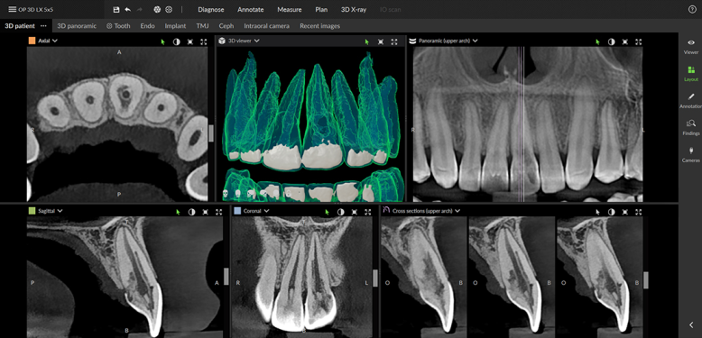 Endodontics