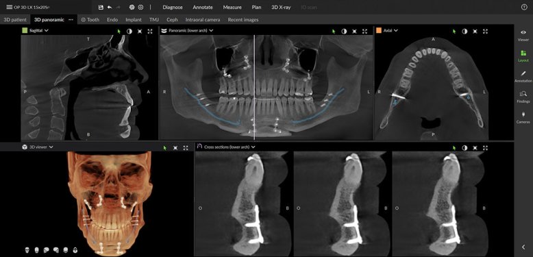 Maxillofacial