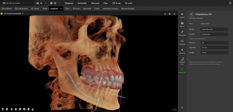 Prosthodontics