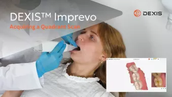 Imprevo Quadrant Scan