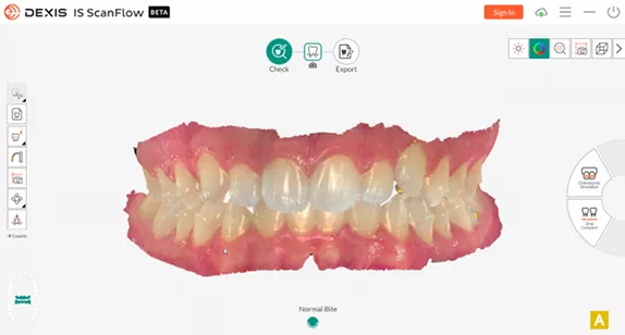 DEXIS Imprevo Vivid, realistic imaging