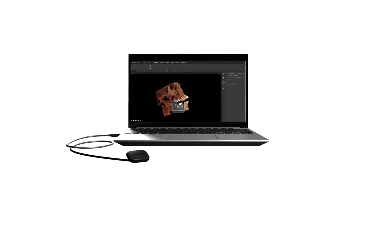 DEXIS ConnectPro