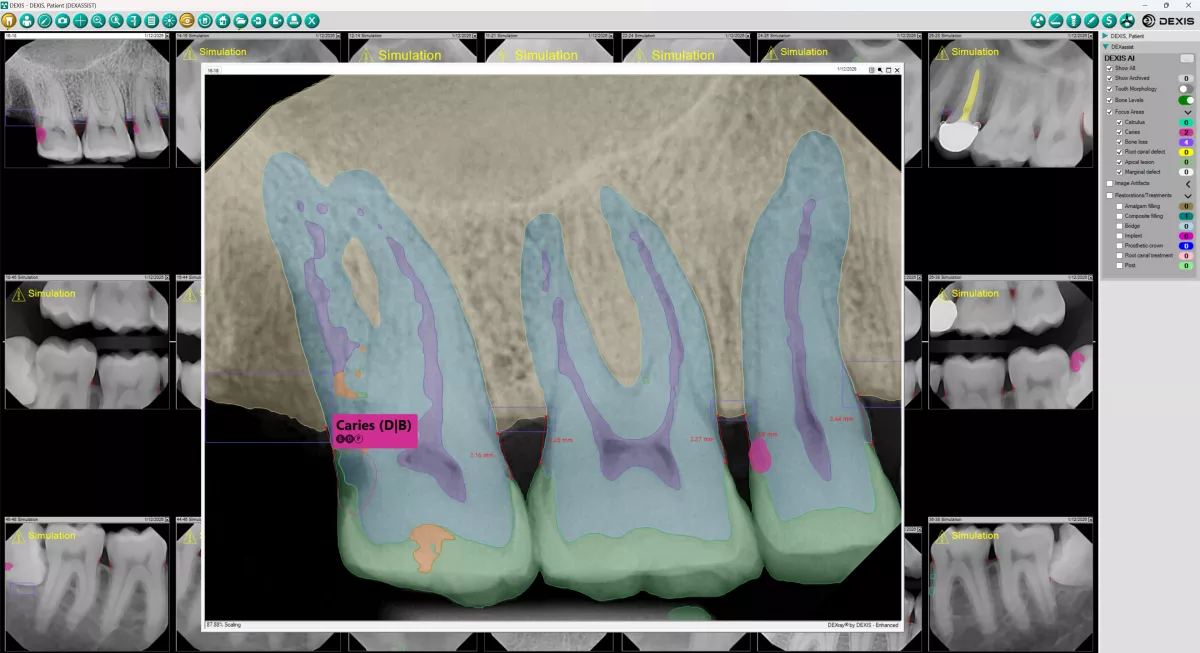 DEXassist Full Screen FMX