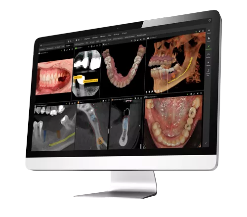 DTX Studio Clinic on a monitor