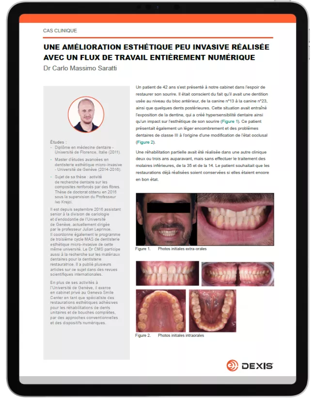 DXIS00282_RevA_Saratti+Restorative+IS+3800W+Case_CC_NA_2023_A4_FR-clinical-case_thumbnail