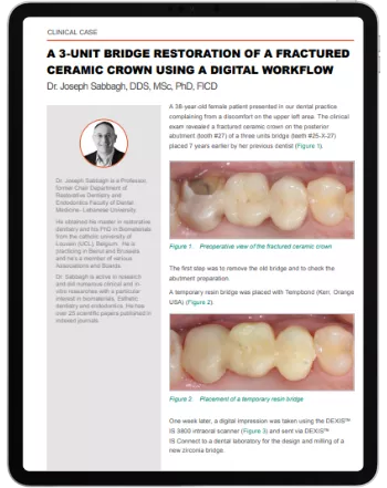 Clinical Case by Dr Joseph Sabbagh: A 3-unit Bridge Restoration Of A Fractured Ceramic Crown Using A Digital Workflow