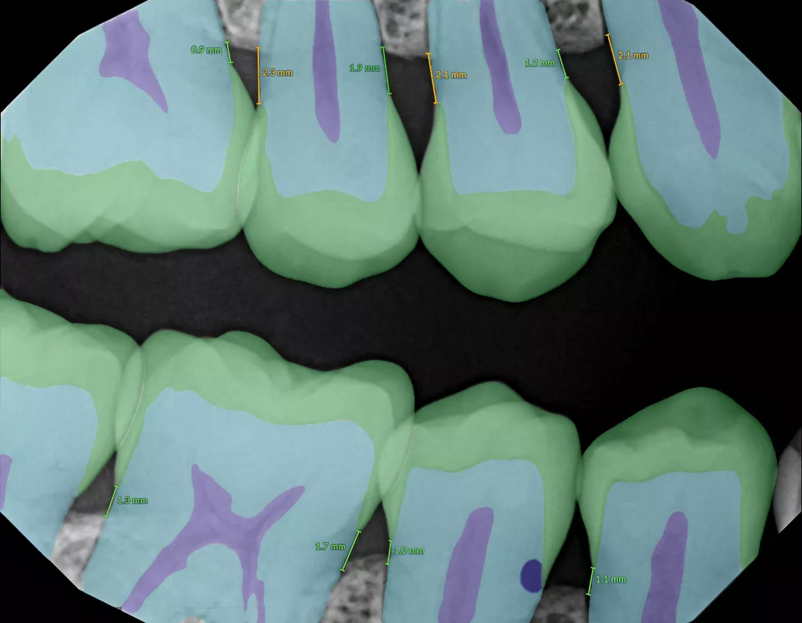 IORXrayColorMeasurement