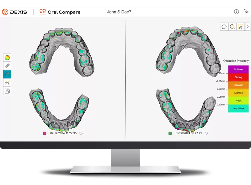 DEXIS IS ScanFlow showing Oral Compare