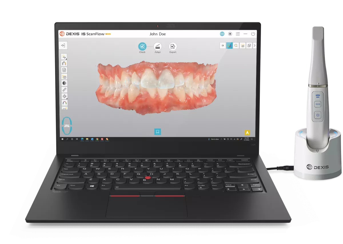 Laptop with IS ScanFlow and the intraoral scanner DEXIS IS 3800W on its dock charging station