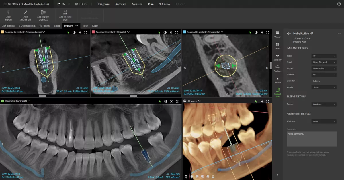 OP 3D EX - Implant Placement