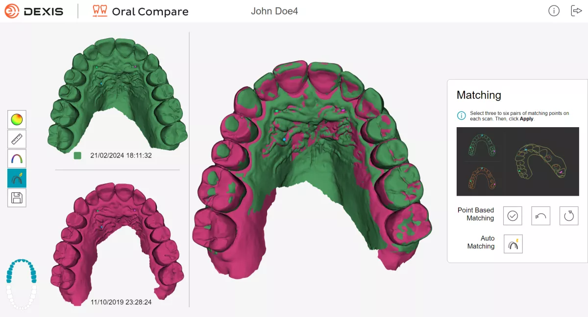 Oral Compare Scan Matching