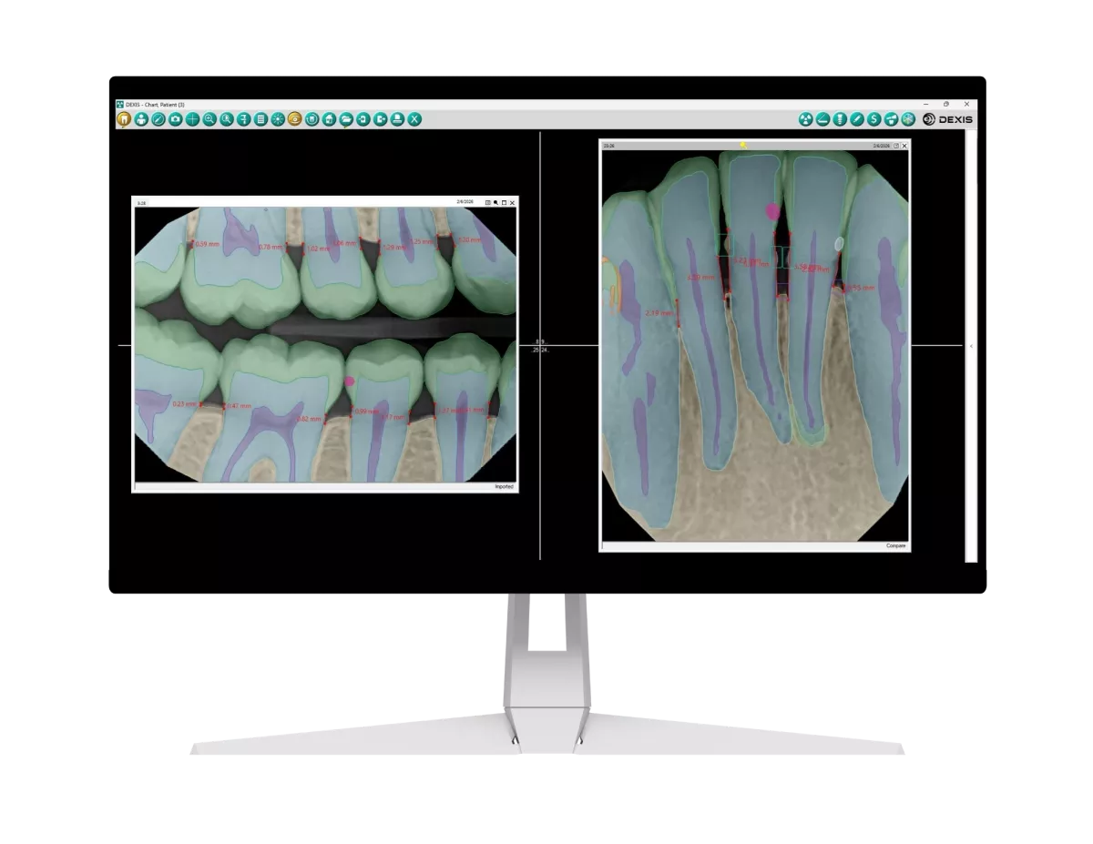 DEXIS Imaging Software monitor