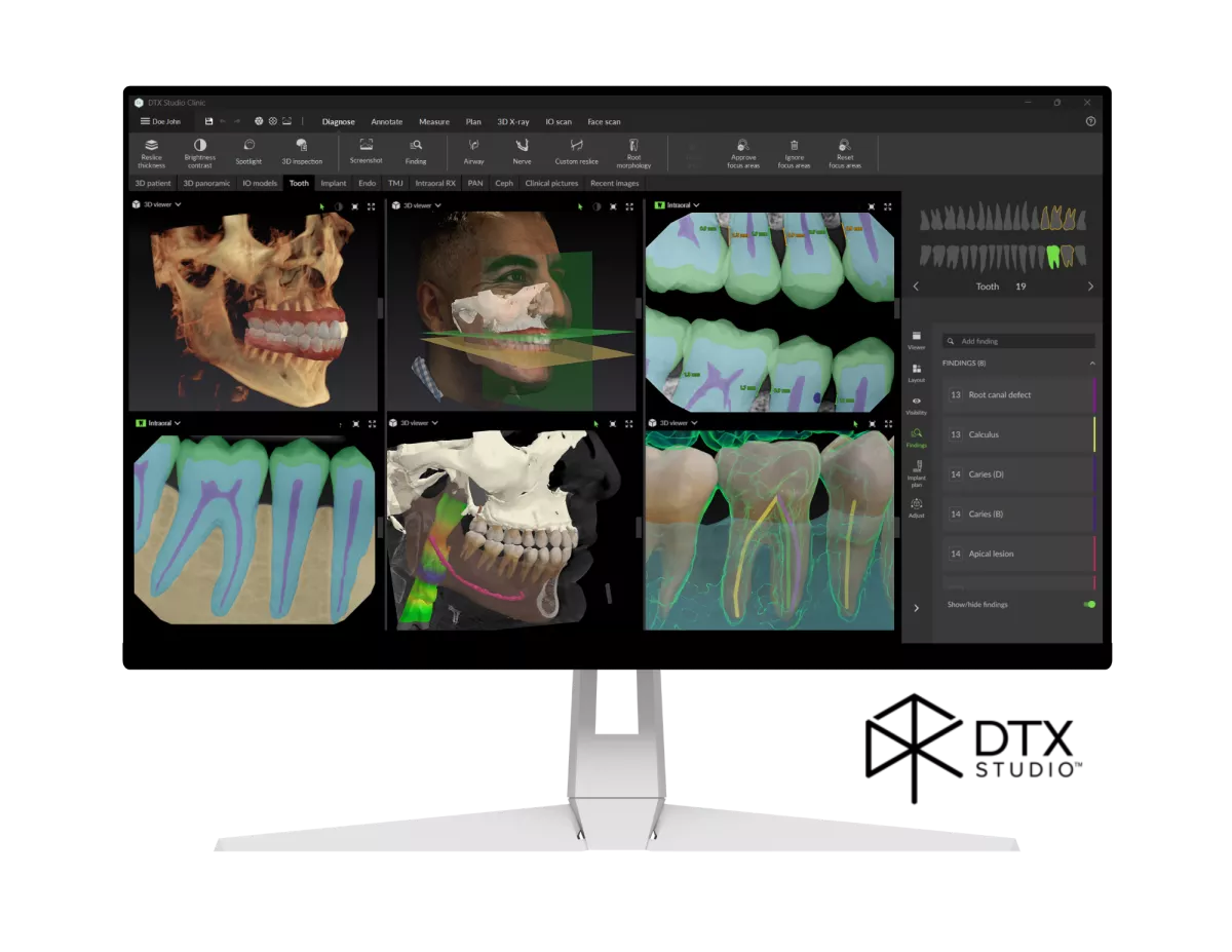 DTX Studio Clinic monitor