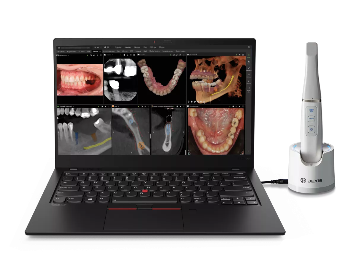 DTX studio clinic w scanner