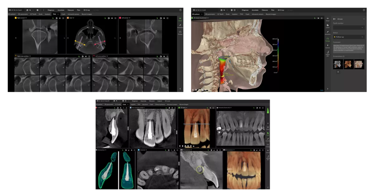 DTX Studio Clinic: Setup of TMJ, endo, and airway workspaces