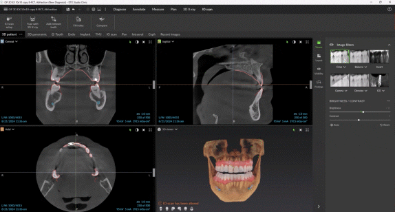 DTX-Stuio-Clinic_treatmet-in-minutes