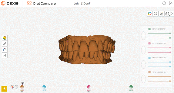 IS-ScanFlow_Visualize-progressive-dental-issues