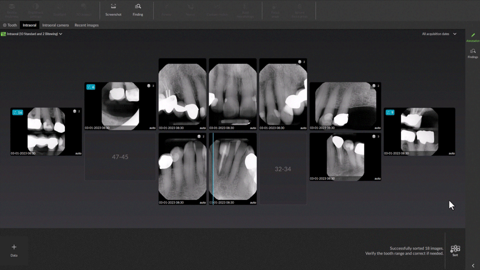 2D AI dental findings