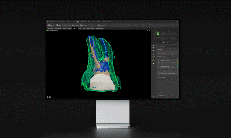 DTX 4.10_Endo