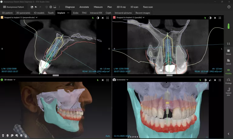 DTX Studio Clinic_Face Scan Implant