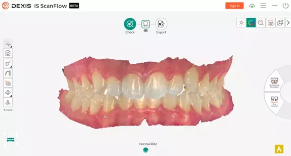 Imprevo_Vivid,-realistic-imaging