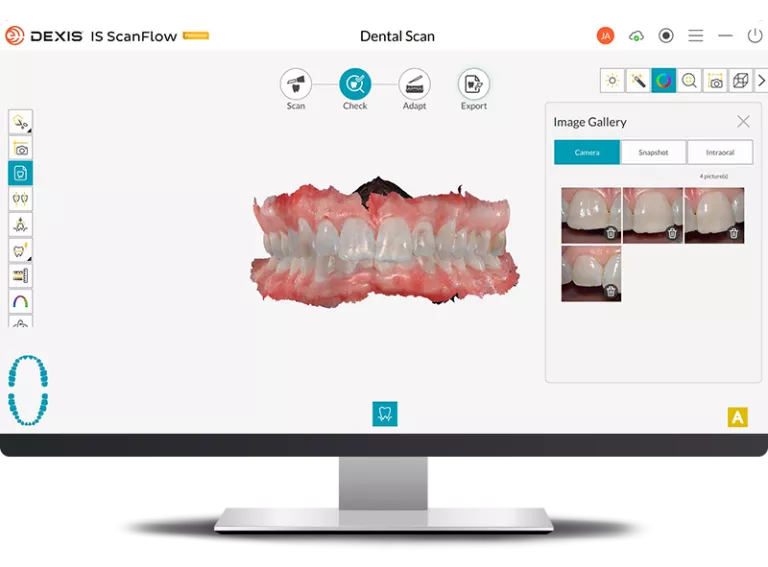 DEXIS-IS ScanFlow Check