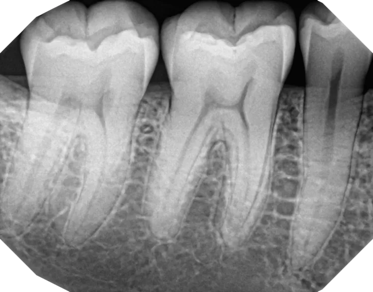 DEXIS Ti2 x ray