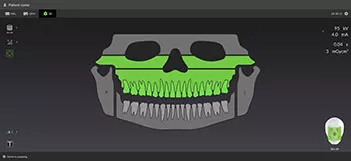OP-3D-LX-GUI