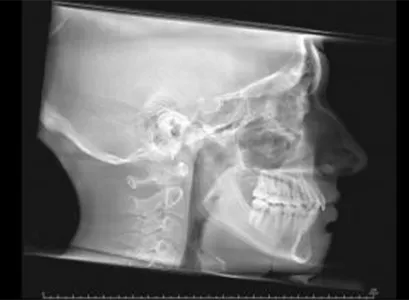 i-CAT-FLX-V Ortho