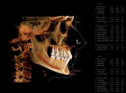 i-CAT-FLX V Ortho