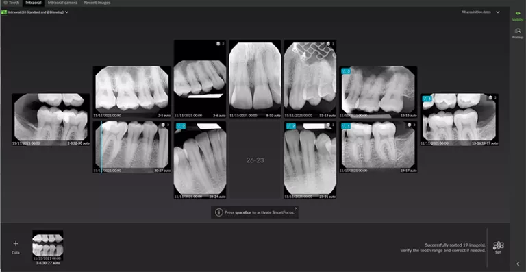 Use AI to instantly recognize, orient, and mount teeth on a template
