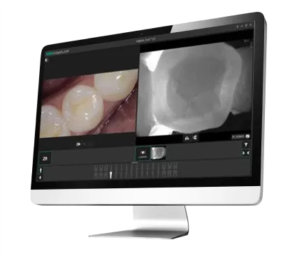 GENDEX software