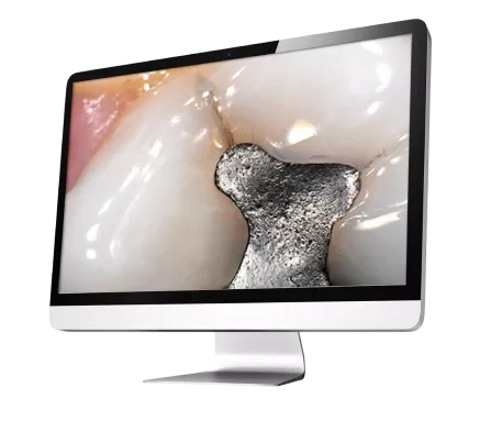 KaVo Imaging Implant X500 DTX