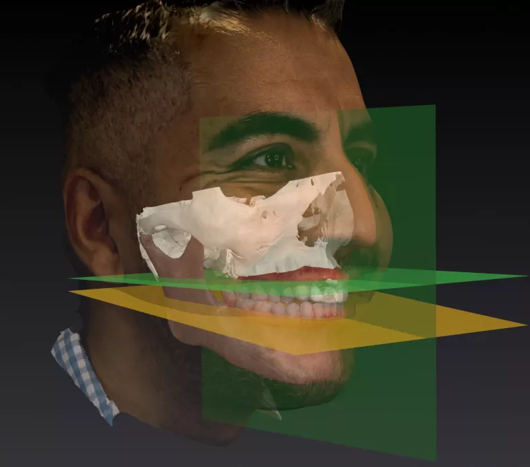 FaceScan