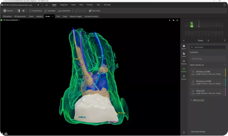 root canal anatomy in 3D
