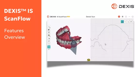 DEXIS™ IS ScanFlow 1.0.11 Overview