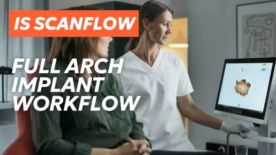 Full arch implant workflow