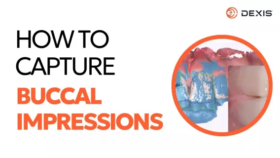 How to capture a buccal dental impression