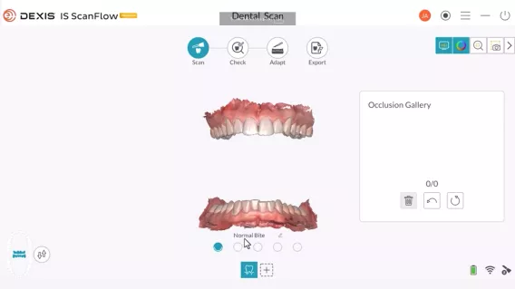 How to scan multiple bites & adjust the orientation of a scan