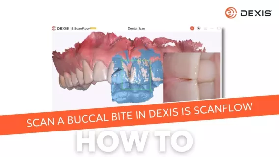How to scan the buccal bite in your intraoral scanning software