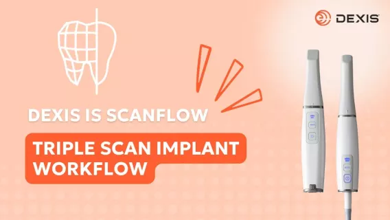 Triple scan implant workflow with IS ScanFlow intraoral scanning software