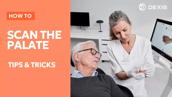 Scanning the palate tips and tricks for IS ScanFlow intraoral software
