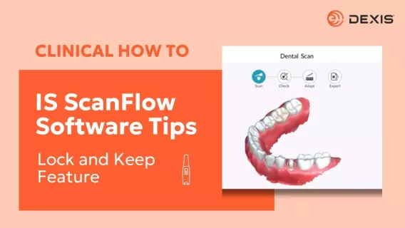 Using the lock and keep Tools for intraoral scanners in IS ScanFlow