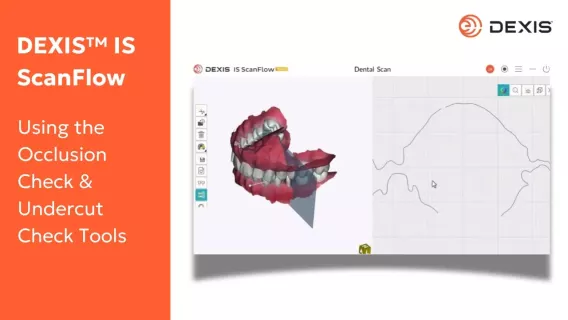 Using the occlusion check & undercut check tools