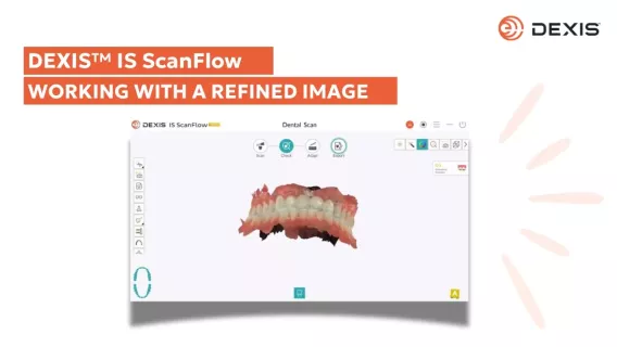 Working with a refined image in your intraoral scanning software