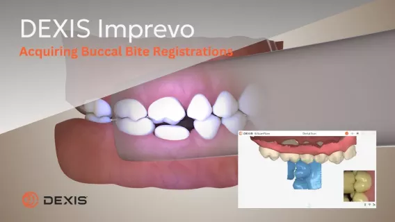 DEXIS™ Imprevo - Acquiring Buccal Bite Registrations
