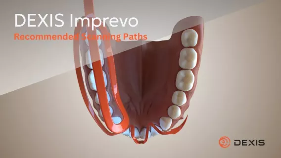 DEXIS™ Imprevo - Recommended Scanning Paths