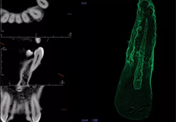 Endodontic Visualization